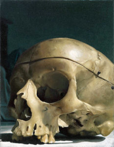 : Skull
